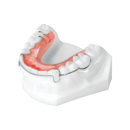 Circumferential Retainer | Universal Orthodontic Lab