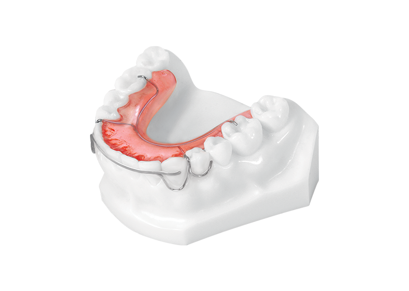 Hawley Retainer With Flat Bow (lower) - Universal Orthodontic Lab