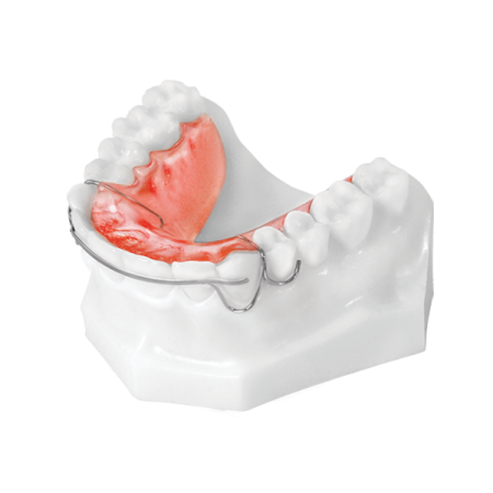 Hawley Retainer with Flat Bow (Lower) - Universal Orthodontic Lab