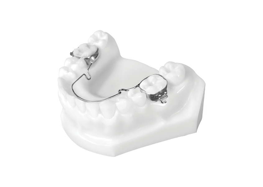 palatal holding arch