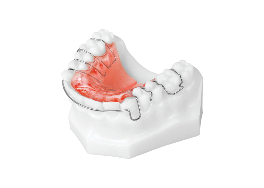 Schwartz Appliance (Upper) - Universal Orthodontic Lab