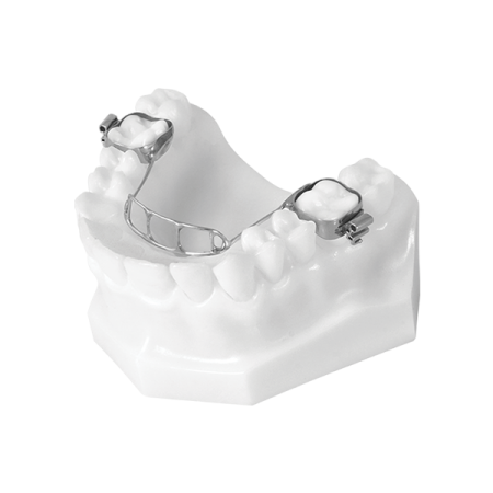 Transpalatal Arch Appliance - Universal Orthodontic Lab