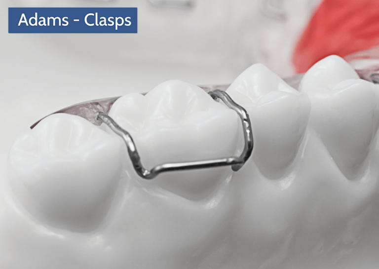 Clasps | Universal Orthodontic Lab