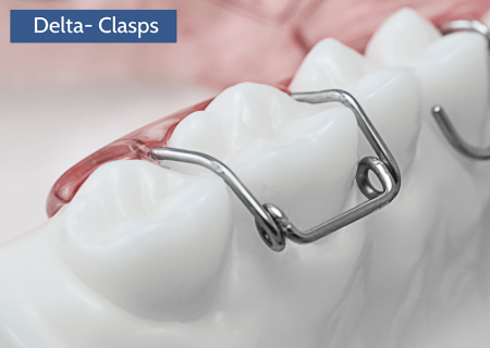 Clasps | Universal Orthodontic Lab